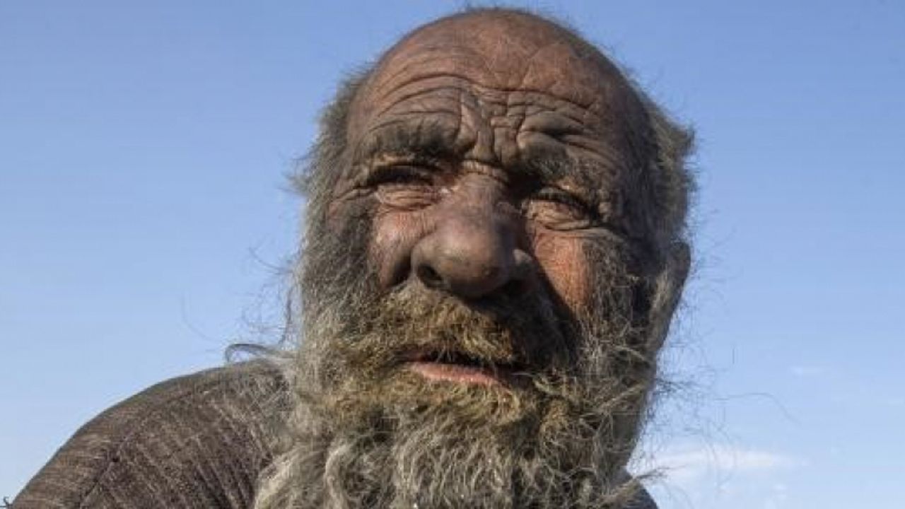 70 yıldır yıkanmadı, yıkandıktan sonra öldü