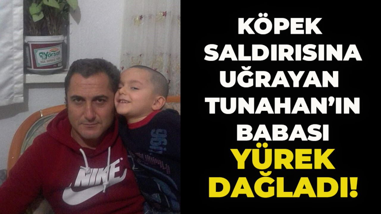 Ankara'da Sokak Köpeklerinin Saldırısına Uğrayan Çocuğun Babası Konuştu