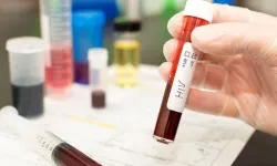 Bilim İnsanları HIV’i Enfekte Hücreden Ayırmayı Başardı