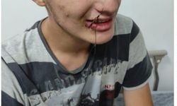 Bursa'da oltaya bu kez çocuk takıldı