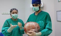 Kadının karnından karpuz kadar kitle çıkarıldı