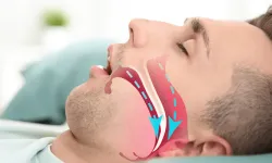 Uyku apnesi kalp krizi ve inme riskini artırıyor