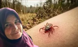Çorum'da kenenin ısırdığı kadın hayatını kaybetti