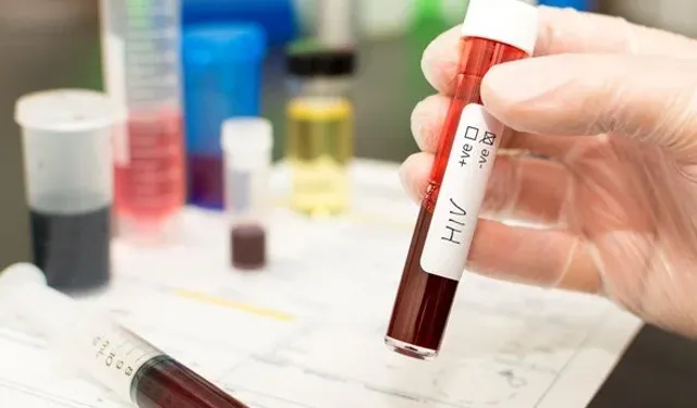 Bilim İnsanları HIV’i Enfekte Hücreden Ayırmayı Başardı