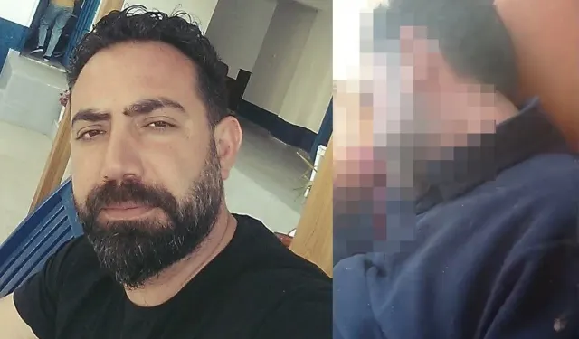 Diş hekimini başından vurdu, videosunu annesine yolladı