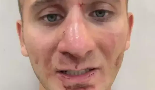 Türk gezgin Ekvator’da saldırıya uğradığını paylaştı