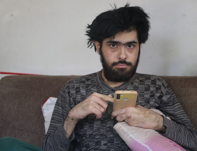 Depremzede genç 3 yıldır dışarı çıkmıyor
