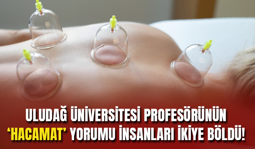 Uludağ Üniversitesi Profesörünün Hacamat Yorumu Çok Konuşuldu