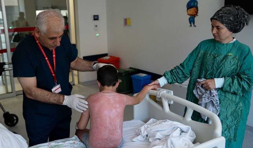 Güneşte 4 saat kaldı! İkinci derece yanıkla hastanelik oldu