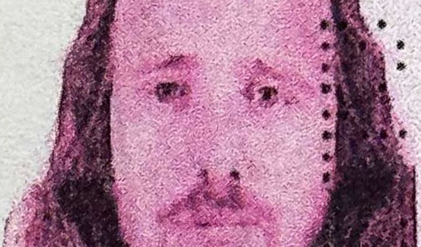 Saç ekimi ve diş tedavisi ardından hayatını kaybetti