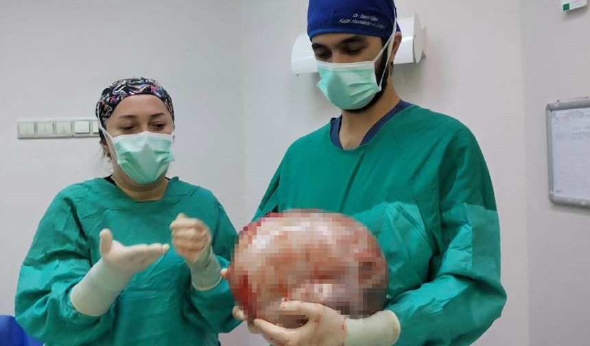 Kadının karnından karpuz kadar kitle çıkarıldı