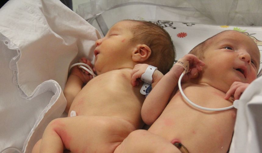 Depremle birlikte öksüz ve yetim kalan siyam ikizi kardeşleri ölüm ayırdı