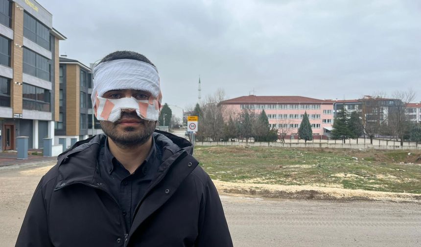 Öğretmen, öğretmenin yüzüne sıcak çay fırlattı, yüzü yandı