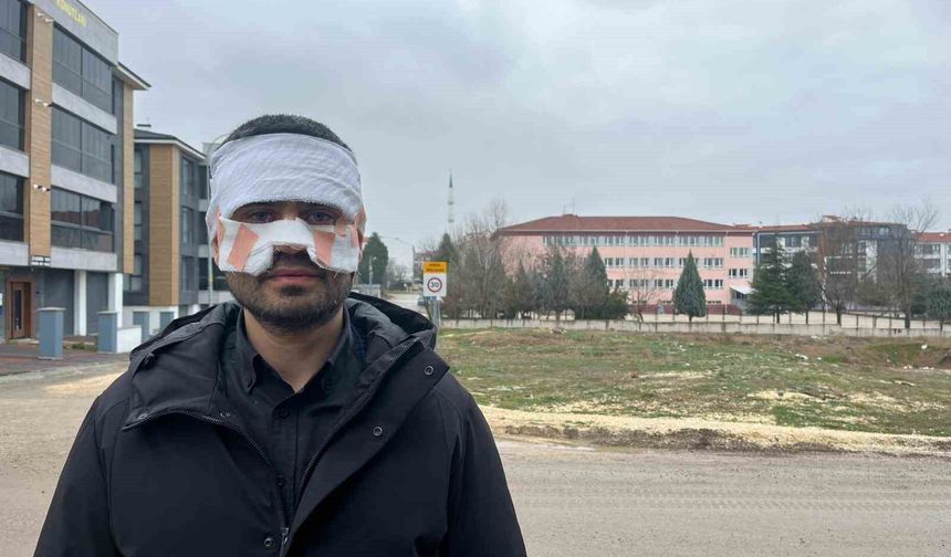 Öğretmen, öğretmenin yüzüne sıcak çay fırlattı, yüzü yandı