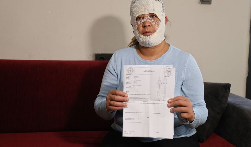 Güzelleşmek uğruna gittiği merkezde yüzü yandı